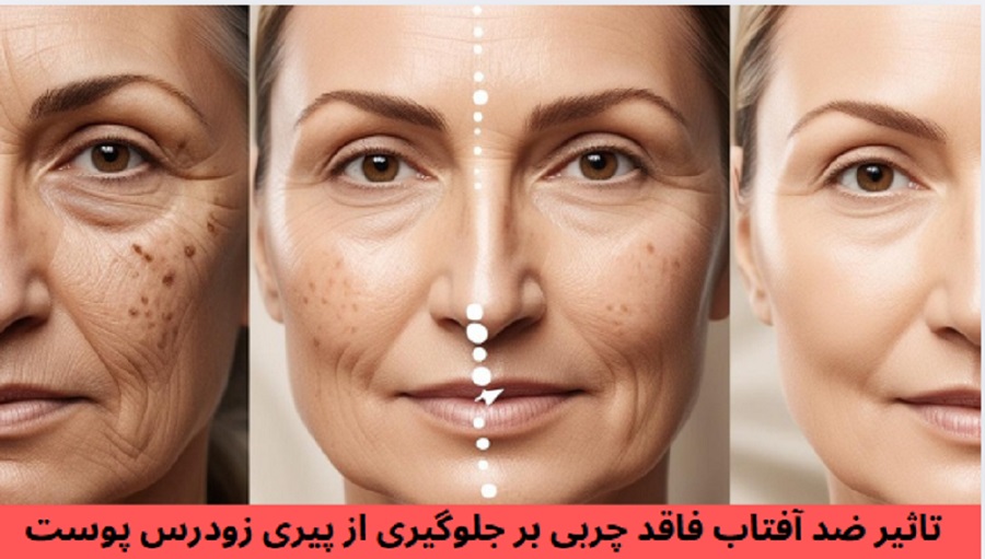 تاثیر ضد آفتاب Oil Free بر جلوگیری از پیری زودرس پوست